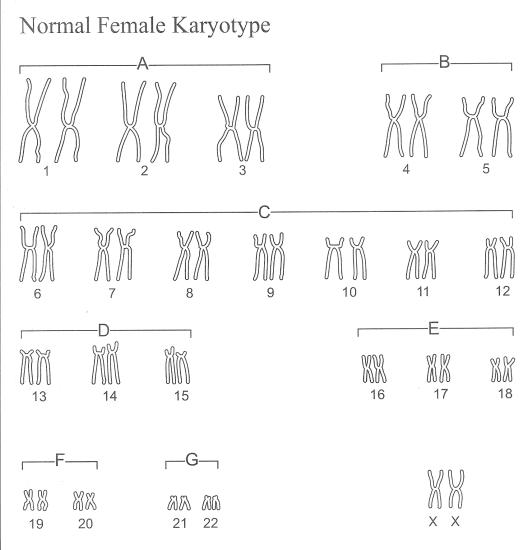 Karyotype Worksheet Biology Answer Key Answers Lab Human Triple Syndrome Wo...
