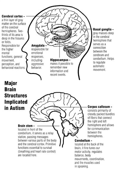 Aspergers Syndrome