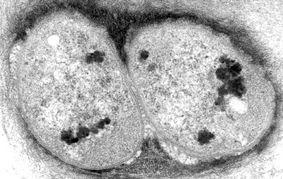 Bacteria Microscope Cells Dividing