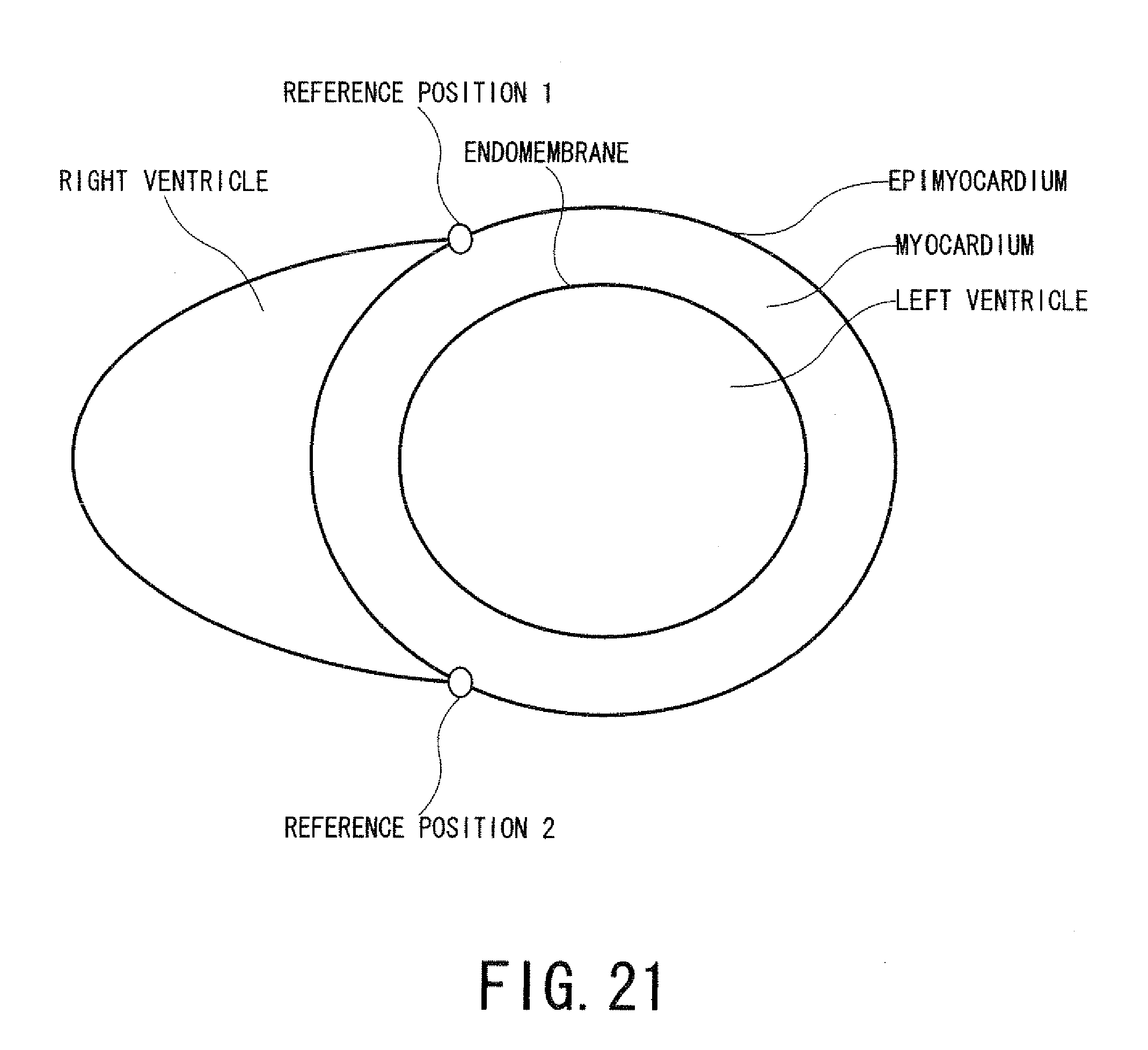 Human Eye Diagram Unlabeled